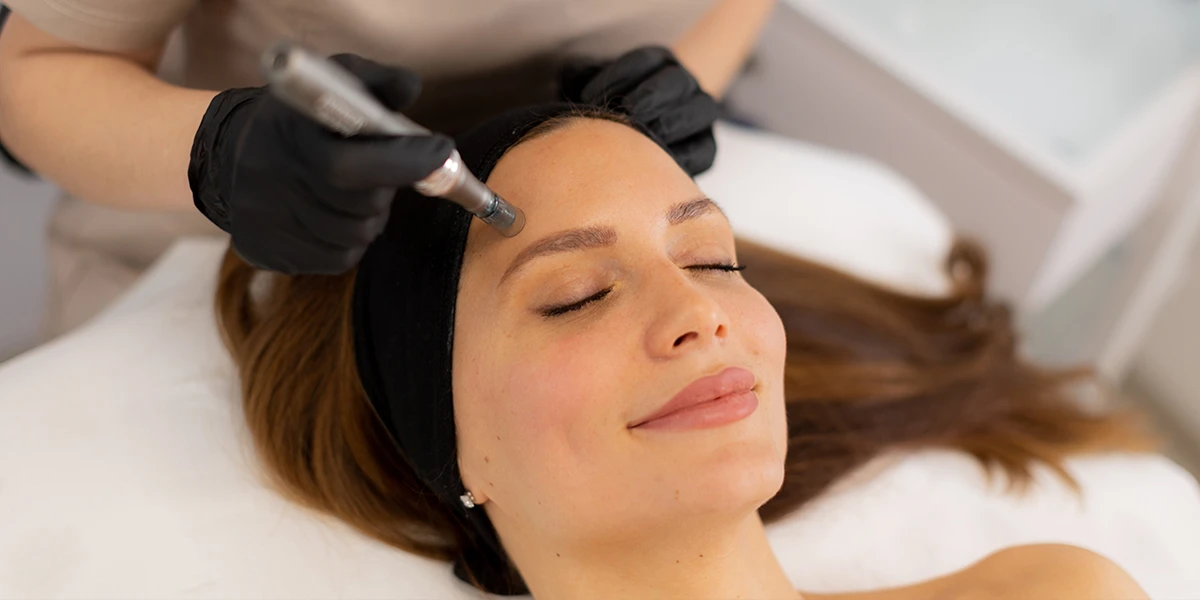 Woman receiving a microneedling facial treatment in a spa